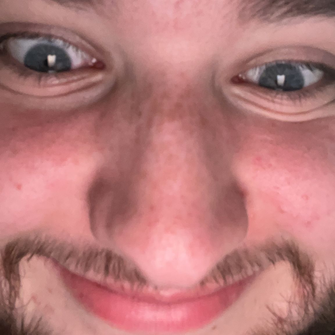 D0SBy